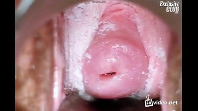 Ukuhlolwa kwe-gynecological yowesifazane omhle